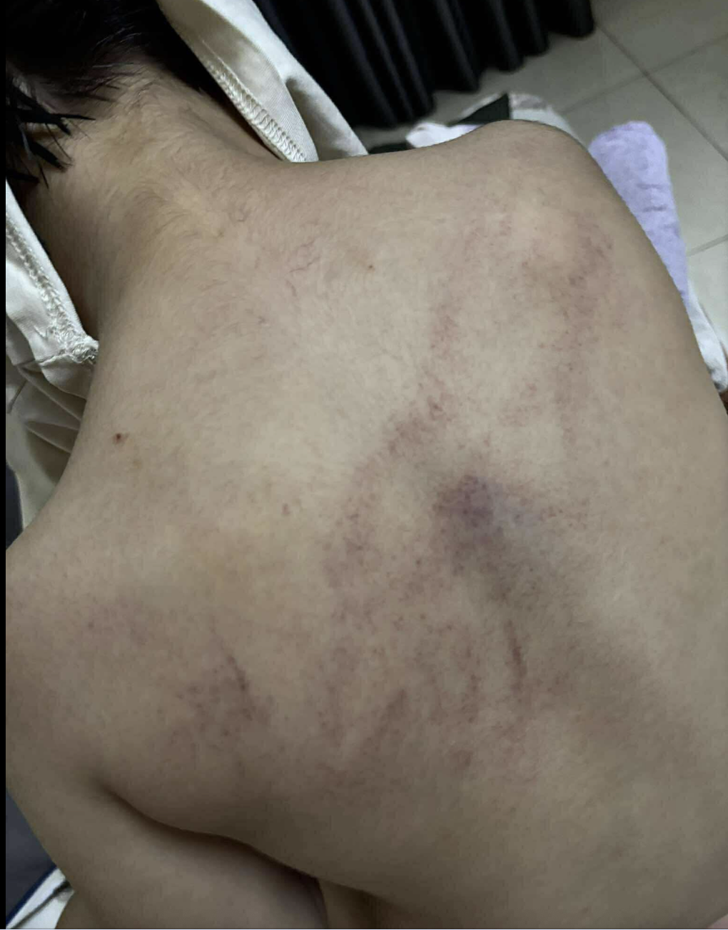 Vụ trẻ nghi bị giáo viên mầm non bạo hành: Công an vào cuộc xác minh - 1 Vụ trẻ nghi bị giáo viên mầm non bạo hành: Công an vào cuộc xác minh - 1