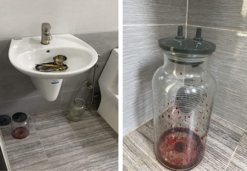 Phát hiện bình máu tươi trong cơ sở chăm sóc da - 2 Phát hiện bình máu tươi trong cơ sở chăm sóc da - 2
