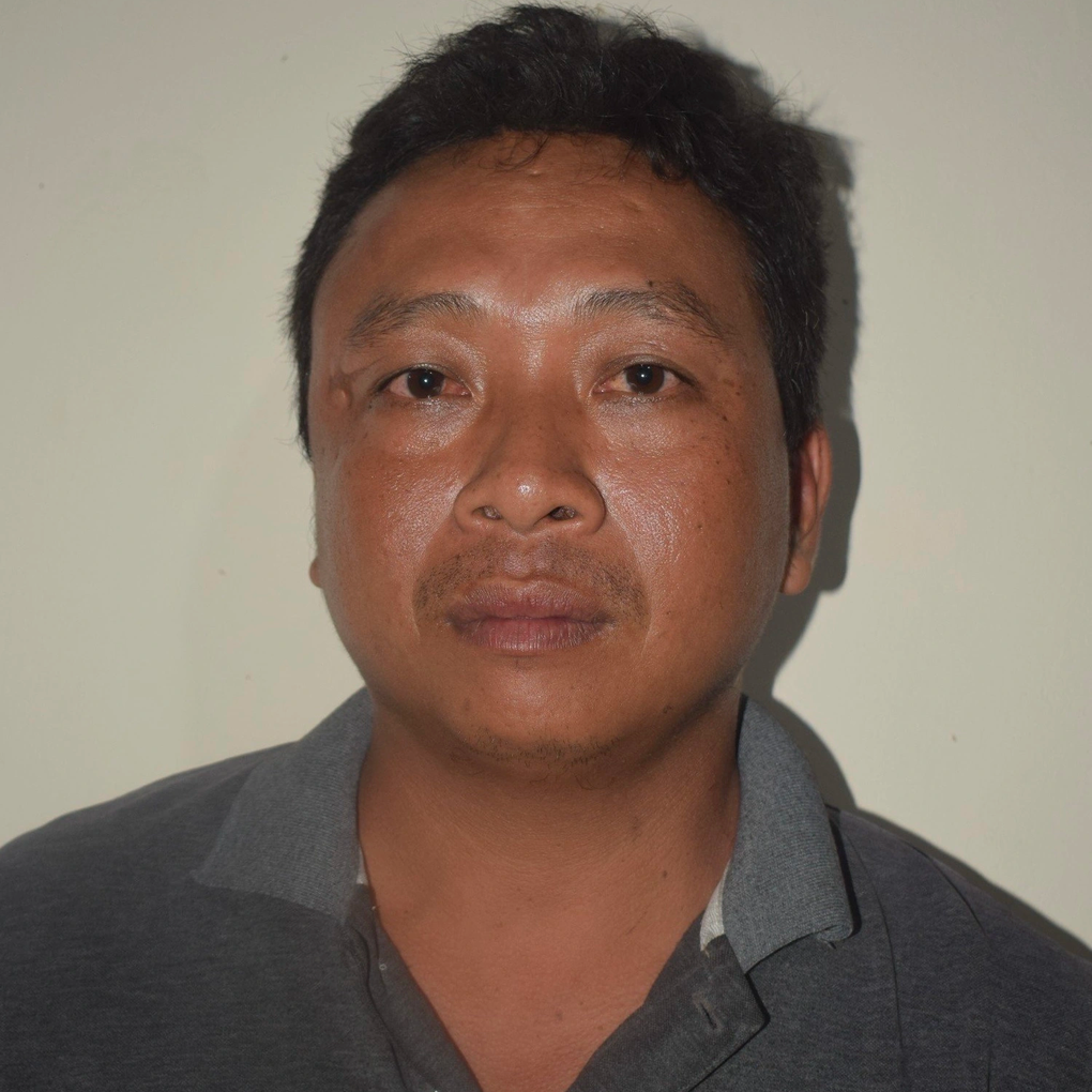 Bị nện búa vào đầu vì can ngăn đánh nhau - 1 Bị nện búa vào đầu vì can ngăn đánh nhau - 1