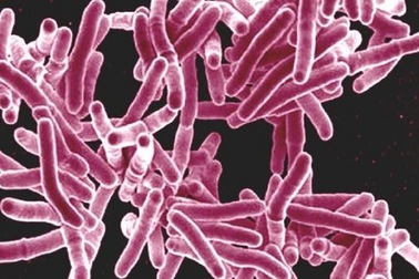 Năm 2050, “siêu vi khuẩn” kháng thuốc có thể giết 10 triệu người mỗi năm