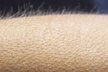 Tại sao chúng ta nổi da gà?