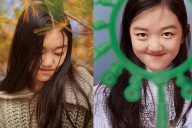 Tình cảm của người cha vĩ đại Lý Á Bằng dành cho cô con gái bị dị tật môi bẩm sinh