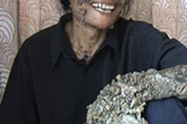 Video “người cây” ở Indonesia