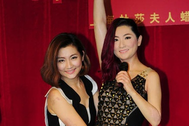 Nữ ca sĩ bị bỏng tự tin tạo dáng bên tượng sáp giống hệt