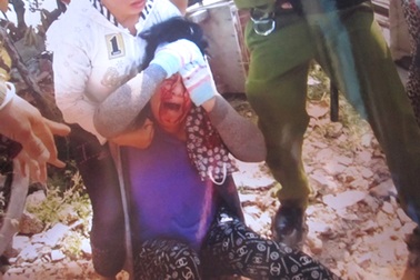 Chánh Thanh tra Sở Y tế bổ cuốc vào đầu một phụ nữ