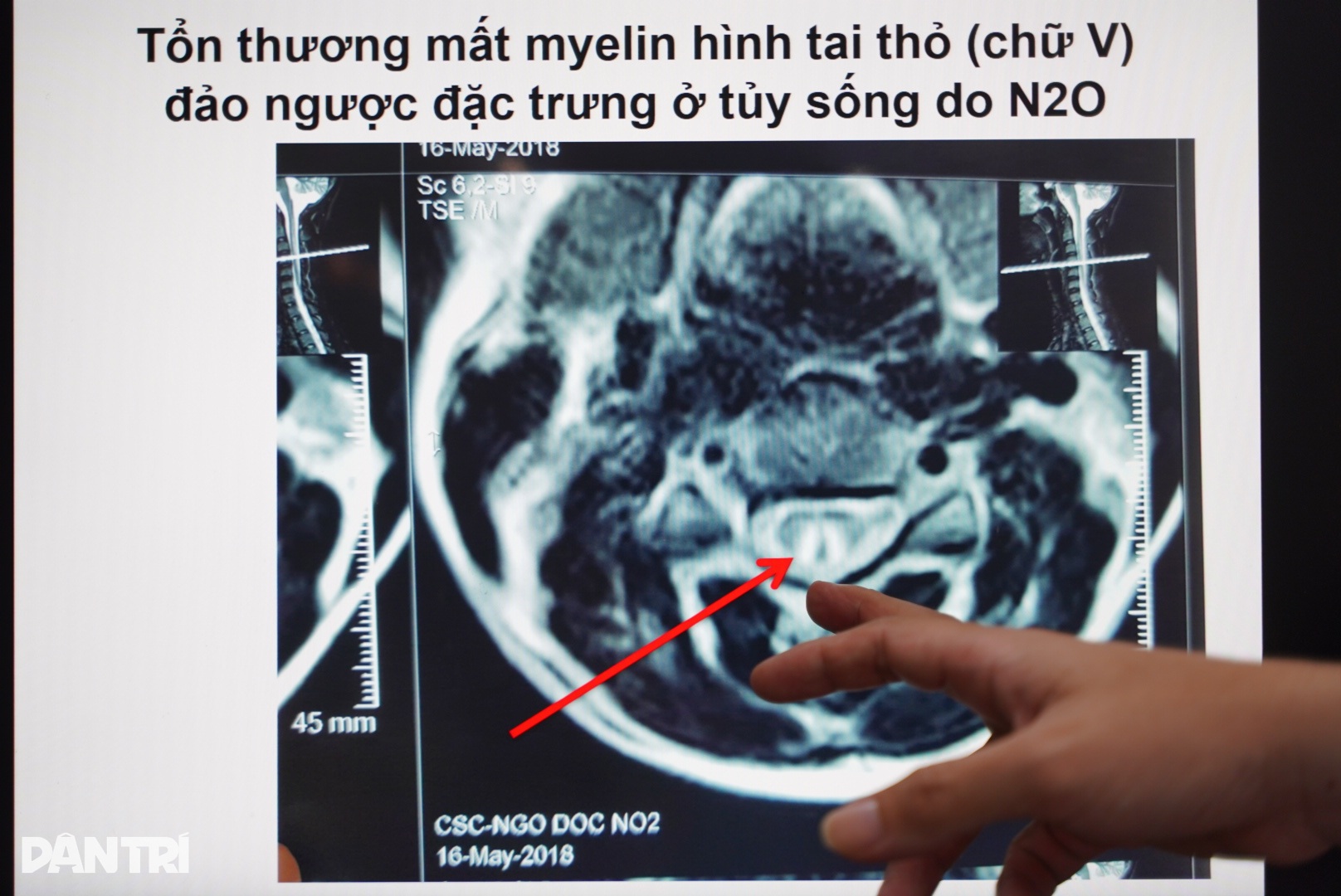 “Đốt tiền vào bóng cười, vợ chồng 9X liệt chân, giảm trí nhớ - 9