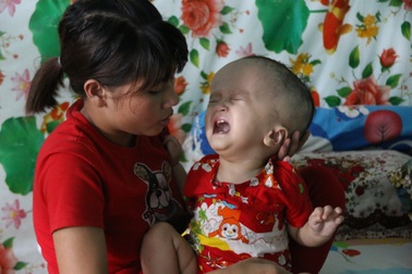 “Trong người chỉ còn vài chục ngàn thì làm sao em đưa con đi mổ được!”