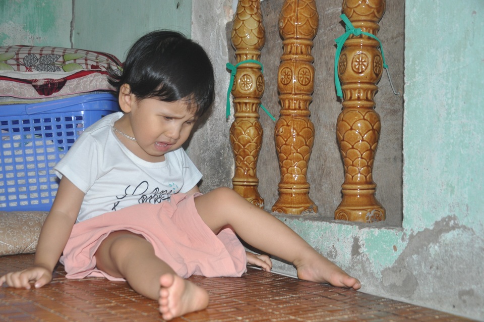 Thương bé gái khi sinh ra đã bị hỏng đôi mắt - 5 Thương bé gái khi sinh ra đã bị hỏng đôi mắt - 5
