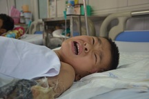 Thương cậu bé 6 tuổi bị công nông chèn dập nát cánh tay, gia đình kiệt quệ