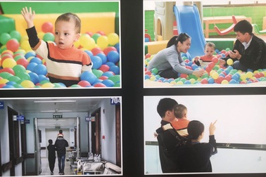 Tưởng bé chậm lẫy, chậm vận động hóa bệnh hiếm gặp