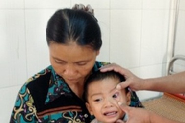 Săn chim trời, nhiều người bị cò mổ mất mắt