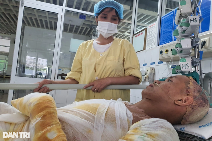 Chàng trai trẻ bốc cháy như ngọn đuốc, bỏng 71% cơ thể - 5