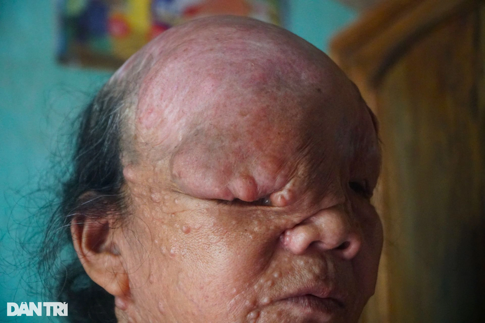 Sóng gió cuộc đời người đàn bà mang khuôn mặt quỷ - 7 Sóng gió cuộc đời người đàn bà mang khuôn mặt quỷ - 7