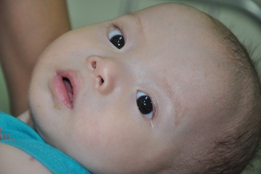 Bị tăng áp phổi nặng, bé 8 tháng tuổi chờ ngày được mổ tim