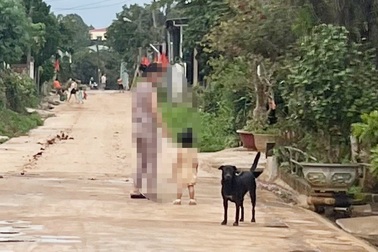 Bị chó cắn 2 tháng trước nhưng giấu gia đình, bé trai tử vong vì bệnh dại