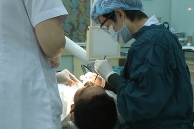 Rụng răng vì thuốc tẩy trắng răng