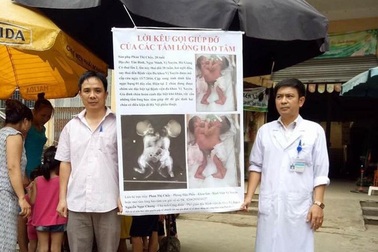 Sức khỏe cặp song sinh dính nhau được bác sĩ quyên tiền diễn biến xấu