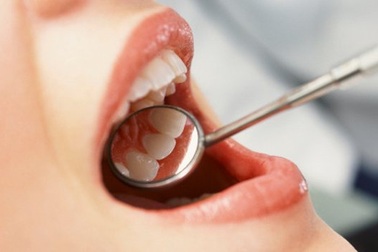 Chảy máu chân răng – biểu hiện ban đầu của nhiều bệnh lý ở chân răng