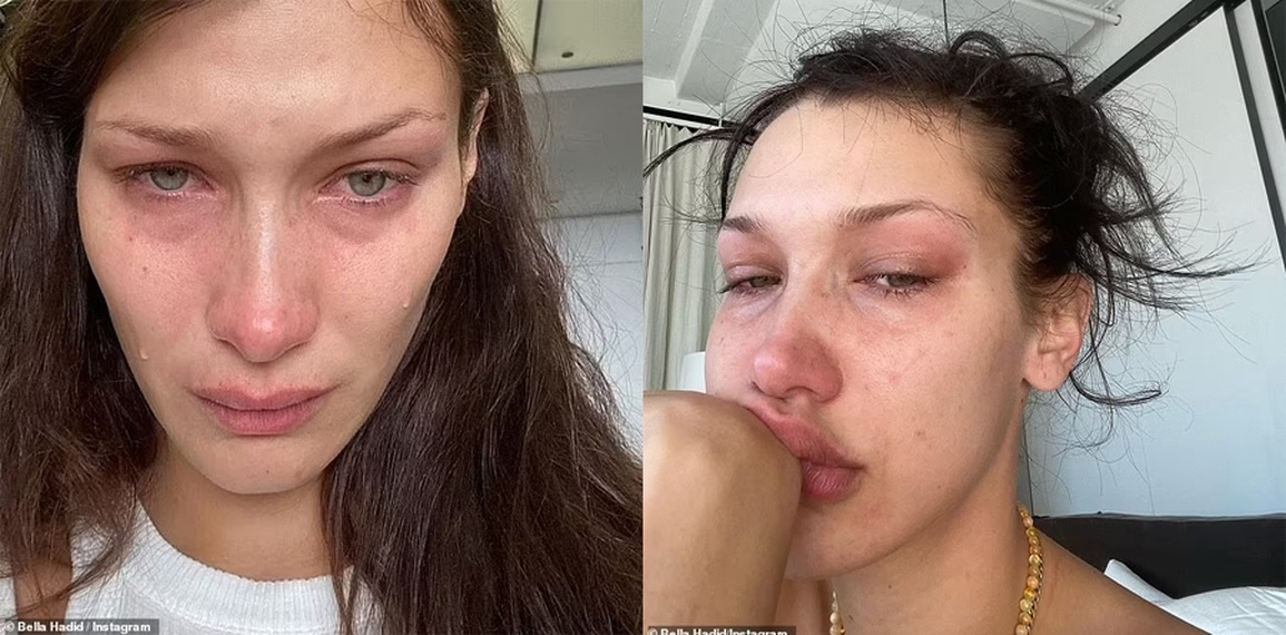 Siêu mẫu Bella Hadid thừa nhận bị trầm cảm, thức dậy là khóc - 2 Siêu mẫu Bella Hadid thừa nhận bị trầm cảm, thức dậy là khóc - 2