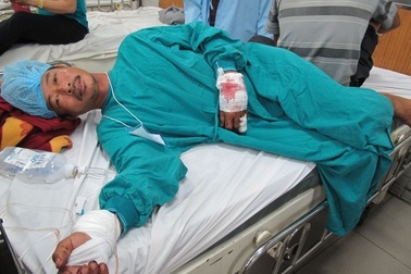  Khỉ đứt xích cắn nát hai bàn tay ông chủ 