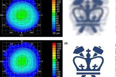 Kỹ thuật khắc phục thị lực không xâm lấn