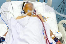 TPHCM: Cứu sống người đàn ông ngưng tim ngã gục khi chơi bóng đá