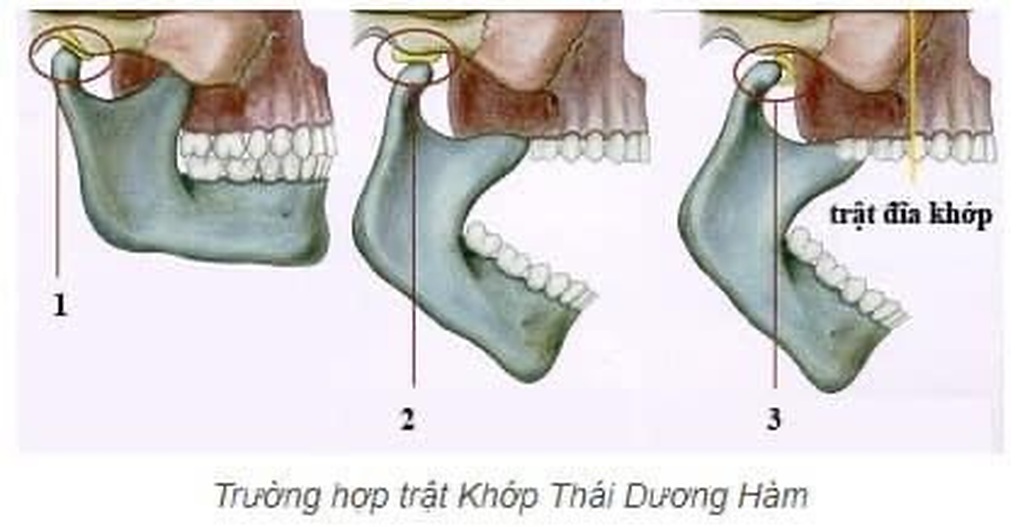 Tin tức 1