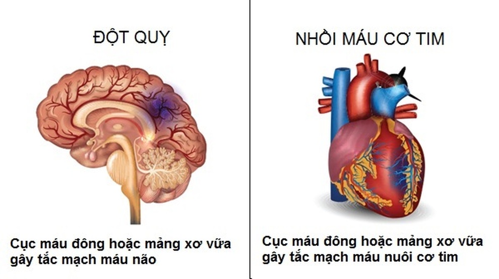 Mỡ máu: Sát thủ thầm lặng ngày càng trẻ hóa - 2 Mỡ máu: Sát thủ thầm lặng ngày càng trẻ hóa - 2