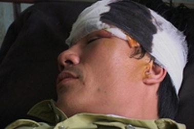 Hối lộ không được quay lại tấn công bảo vệ rừng