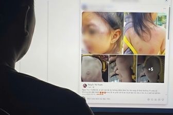 Bé gái 3 tuổi bị nhiều vết bầm tím, dấu răng trên người sau giờ học