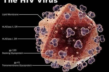Phát hiện chủng vi-rút HIV mới “hung hăng” hơn