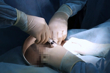 TPHCM: Cô gái 26 tuổi "vỡ" ngực sau khi tiêm filler tăng size ở khách sạn