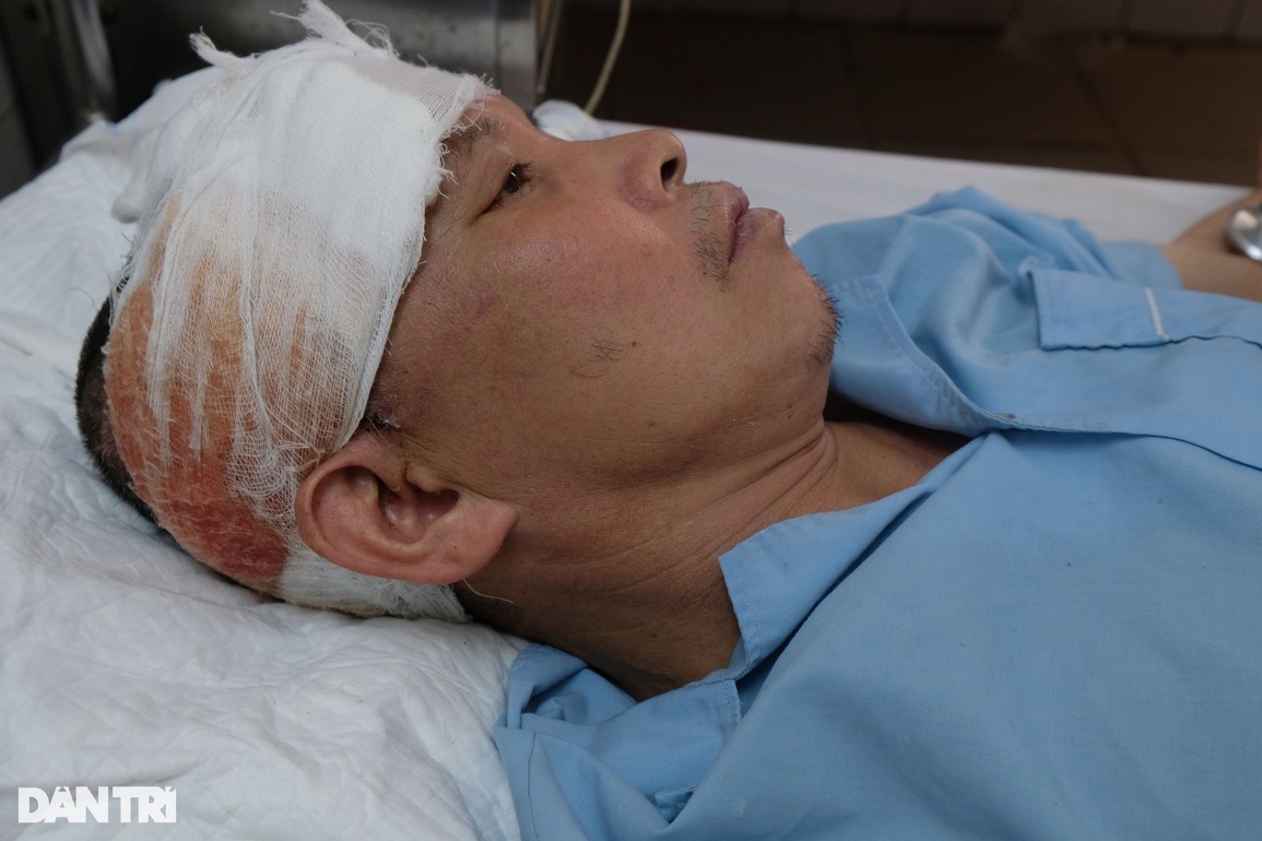 Vợ nghèo cùng đường cầu xin cứu chồng tai nạn chấn thương sọ não - 1 Vợ nghèo cùng đường cầu xin cứu chồng tai nạn chấn thương sọ não - 1