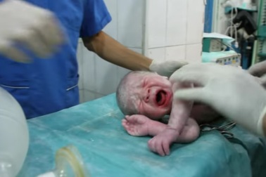 Ca “vượt cạn” kỳ diệu của sản phụ bị thương sau trận không kích ở Syria