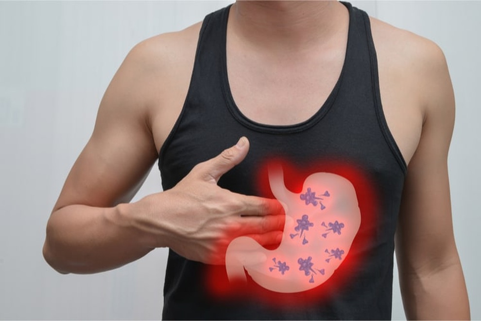 Có một trong các yếu tố này, bạn cần đề phòng ung thư dạ dày - 1 Có một trong các yếu tố này, bạn cần đề phòng ung thư dạ dày - 1