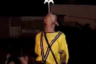 Thủng thực quản vì nuốt kiếm: “Tử thần” rình rập nghề xiếc dạo