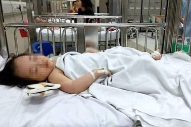 Kết quả chụp CT sọ não của bé gái ngã từ tầng 12A chung cư tại Hà Nội