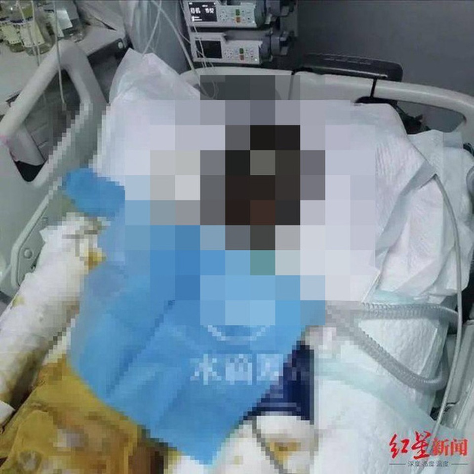 Nữ TikToker nổi tiếng bị chồng cũ thiêu sống khi đang livestream - 2 Nữ TikToker nổi tiếng bị chồng cũ thiêu sống khi đang livestream - 2