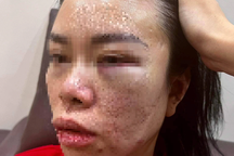 Nghi án người phụ nữ bị chồng cũ bắt giữ, đánh đập hơn một ngày