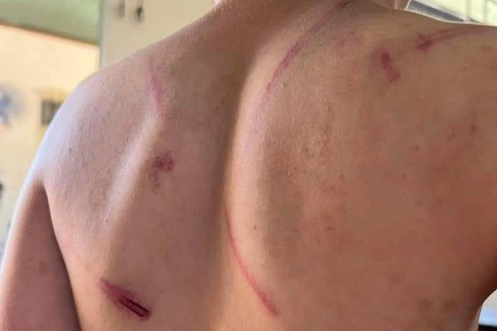 Bé trai 9 tuổi bị bố và bà nội đánh đập kinh hoàng - 1 Bé trai 9 tuổi bị bố và bà nội đánh đập kinh hoàng - 1