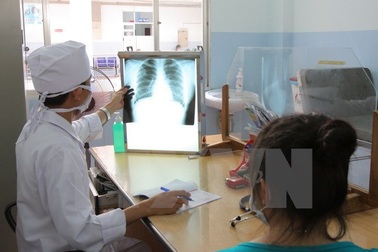 Bước đột phá trong điều trị lao kháng thuốc, tỷ lệ thành công 82%