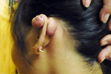Xỏ khuyên tai: Cẩn thận!