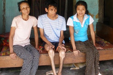  Xót thương cảnh mẹ già nuôi hai con nhiễm chất độc da cam