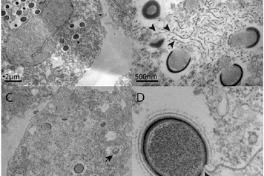 Virus khổng lồ thời cổ đại sống lại khi băng Bắc Cực tan chảy?