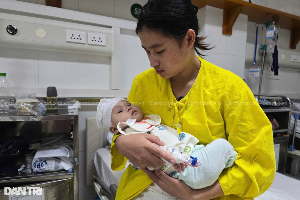 Bé 7 tháng tuổi khuyết hộp sọ, mẹ nghèo khẩn cầu cơ hội sống cho con - 2 Bé 7 tháng tuổi khuyết hộp sọ, mẹ nghèo khẩn cầu cơ hội sống cho con - 2