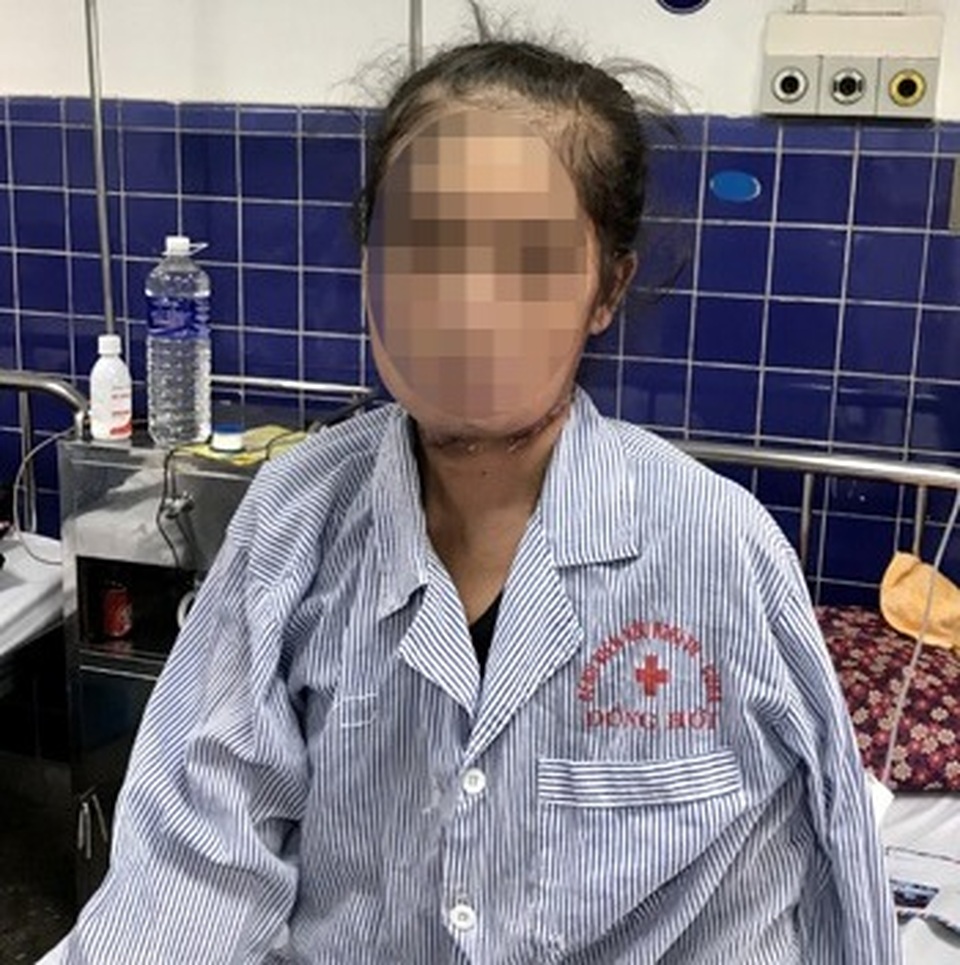 Phẫu thuật thành công cho nữ bệnh nhân bị ung thư lưỡi - 1 Phẫu thuật thành công cho nữ bệnh nhân bị ung thư lưỡi - 1