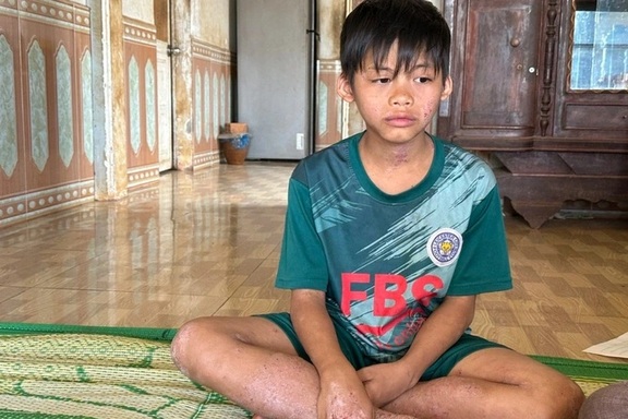 "Giá như mẹ có thể chịu thay con những nỗi đau này!"