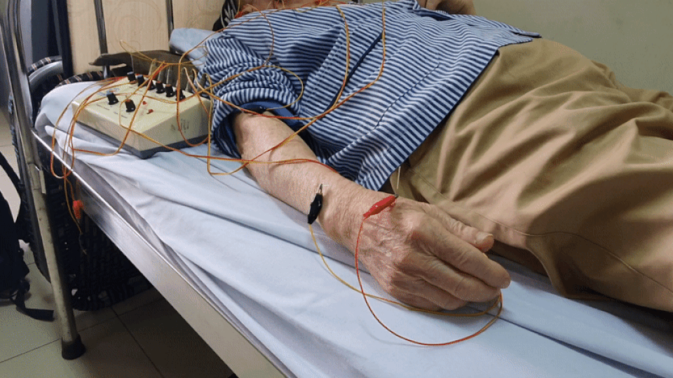 Xem bác sĩ dùng điện châm chữa liệt nửa người cho bệnh nhân đột quỵ - 9 Xem bác sĩ dùng điện châm chữa liệt nửa người cho bệnh nhân đột quỵ - 9