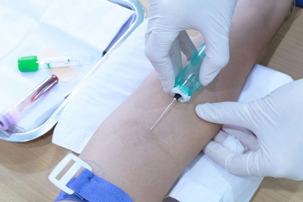Làm 7 xét nghiệm máu này bạn không cần nhịn ăn - 1 Làm 7 xét nghiệm máu này bạn không cần nhịn ăn - 1
