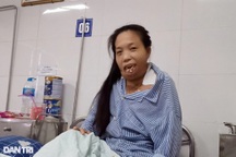 Người đàn bà "33 năm không được mang khuôn mặt con người" có gương mặt mới